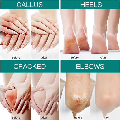 Wholesale Moisturizer Private Label Foot Care Products Best Hand and Foot Whitening Cream Repair Hand Lotion Urea Foot Cream